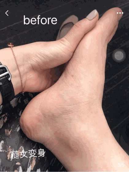 30天让你的「奶奶脚」变成性感「少女